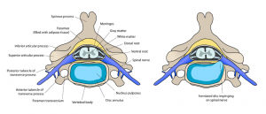 DISC